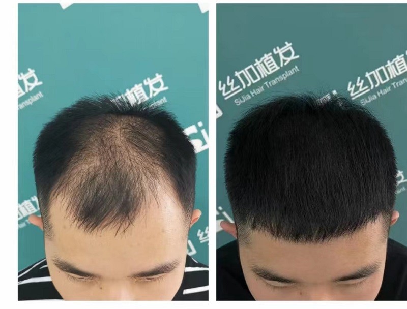 ���_(k��i)ֲ�l(f��)�������漆��һ��ȫ�µ�����֮��